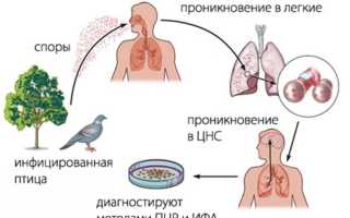 Орнитоз: особенности заболевания, методы диагностики и лечения