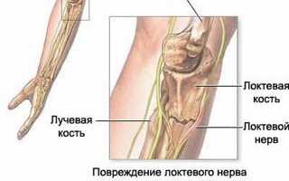 У меня немеет правая рука и нога