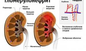 Анализ мочи по Нечипоренко у детей: особенности исследования