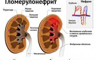 Анализ мочи по Нечипоренко у детей: особенности исследования