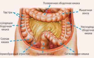 Отдалённые последствия оперативных вмешательств: спаечная болезнь кишечника