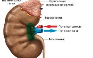 Парапельвикальная киста почки: опасно ли новообразование
