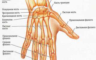Вывих кистевого сустава руки — что это за травма и как её лечат