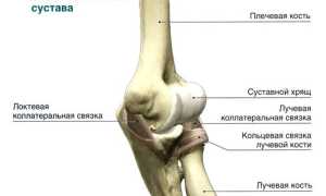 Перелом локтевого сустава: как восстановиться после травмы