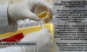 Зачем беременным анализ мочи по Нечипоренко