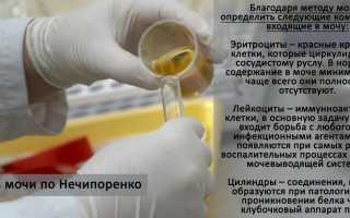 Зачем беременным анализ мочи по Нечипоренко