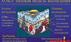 Новое  в лечении  ХОБЛ. Рофлумиласт