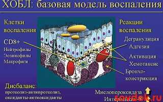 Новое  в лечении  ХОБЛ. Рофлумиласт