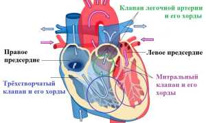 Что такое и насколько опасна лишняя хорда в сердце?