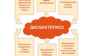Дисбактериоз кишечника: симптомы у детей разного возраста, признаки у женщин и мужчин