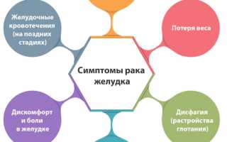 Боли при раке желудка