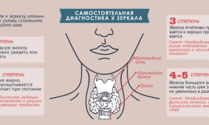 Диета при гипотиреозе — коррекция работы щитовидной железы без медикаментов