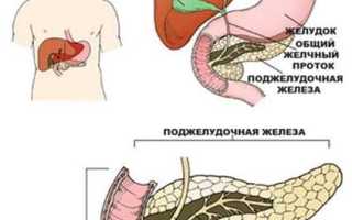 О синдроме нарушенной ассимиляции