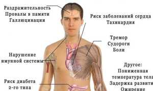 Причины нарушения сна