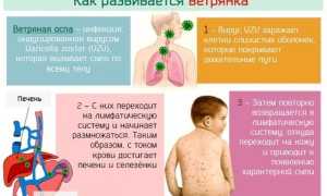 Прыщики у новорождённых и маленьких детей: когда следует беспокоиться