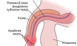 Особенности баланопостита у детей: что нужно знать родителям?