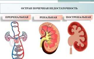 Острая недостаточность почек: как справляться с болезнью
