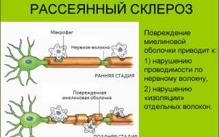 Сила диеты, или Как улучшить состояние при рассеянном склерозе