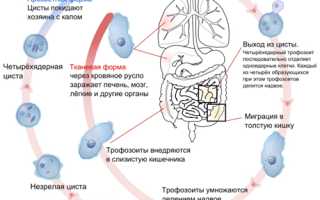 Дизентерия: симптомы и методы диагностики