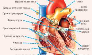 Аортальная  регургитация: проявления,  диагностика,  лечение