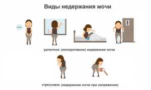 Недержание мочи у пожилых женщин: как справиться с деликатной проблемой