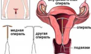 Причины возникновения кисты яичника, на которые стоит обратить  внимание