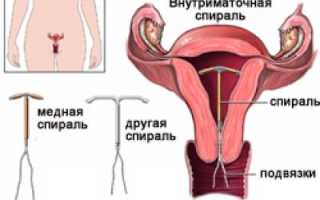 Причины возникновения кисты яичника, на которые стоит обратить  внимание
