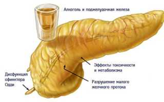 Влияние алкоголя на поджелудочную железу при панкреатите