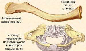 Перелом ключицы: каков план лечения?
