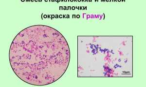 Антибиотики при воспалении почек: обзор препаратов