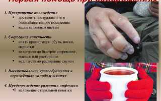 Обморожение конечностей, первая помощь