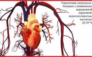 Сердечная недостаточность: разновидности, признаки, диагностика и лечение