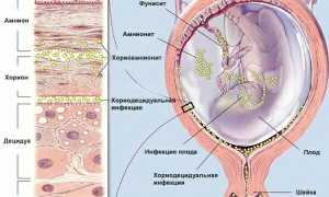 Достижения медицины всё ближе к чудесам