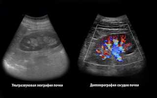УЗИ почек: особенности исследования для женщин