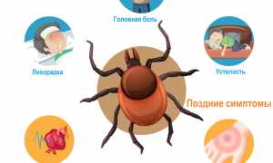 Клещевой боррелиоз и симптомы болезни Лайма