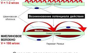 Энцефаломиелит: как выявить и лечить патологию