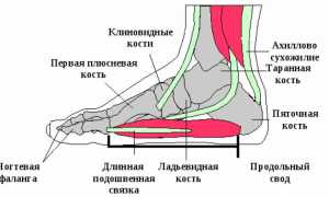 Повреждения пятки: первая помощь и профилактика осложнений