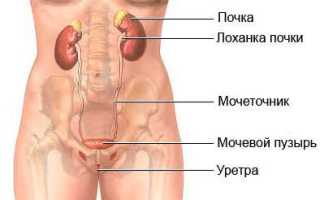Пиелонефрит у женщин — симптомы и лечение