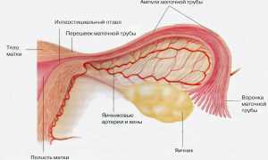 Сальпингит: признаки, диагностика, лечение