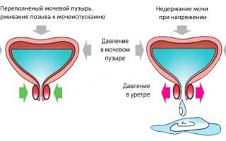 Недержание мочи после родов: как справиться с проблемой