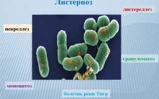 Листериоз у человека — опасное паразитарное заболевание