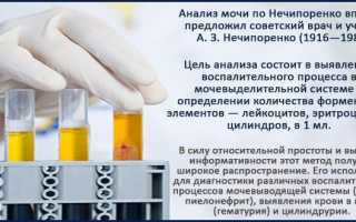 Проба мочи по Нечипоренко: назначение, подготовка и результаты исследования