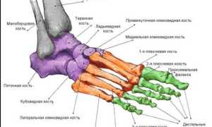 Перелом пятки: как восстановиться после травмы