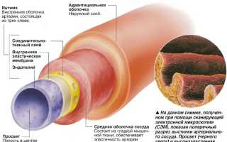 Склероз сосудов головного мозга: как бороться с болезнью