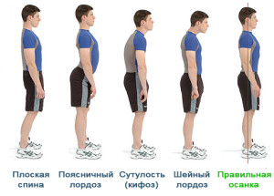 Схема