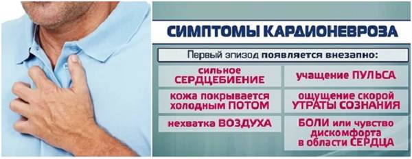Признаки кардионевроза