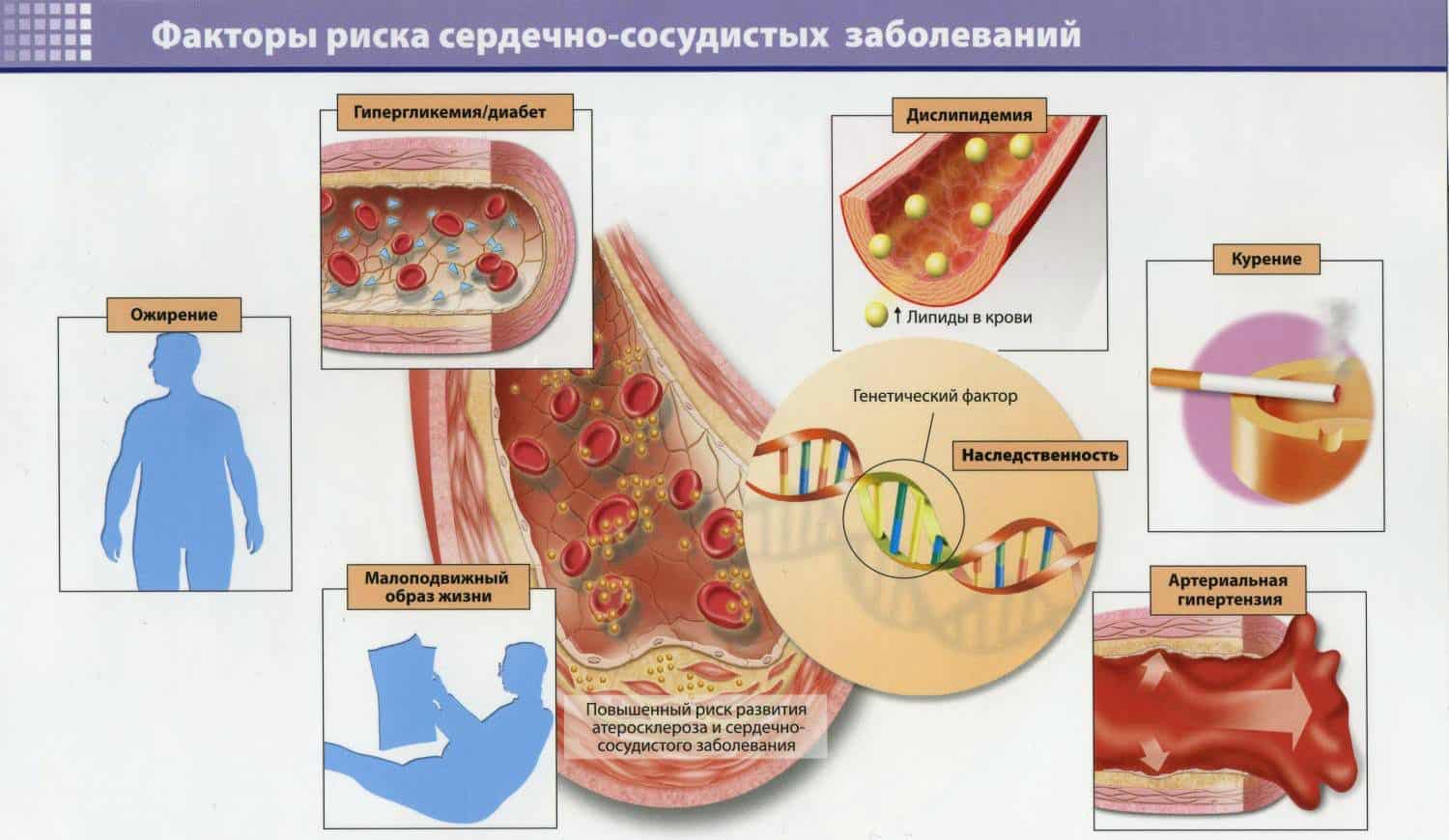 Факторы риска развития атеросклеротического кардиосклероза