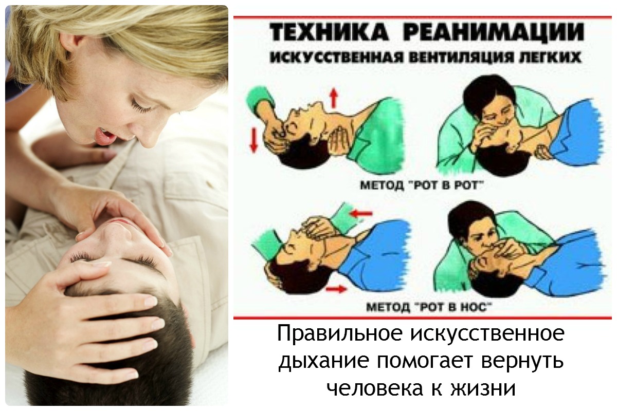 Искусственное дыхание