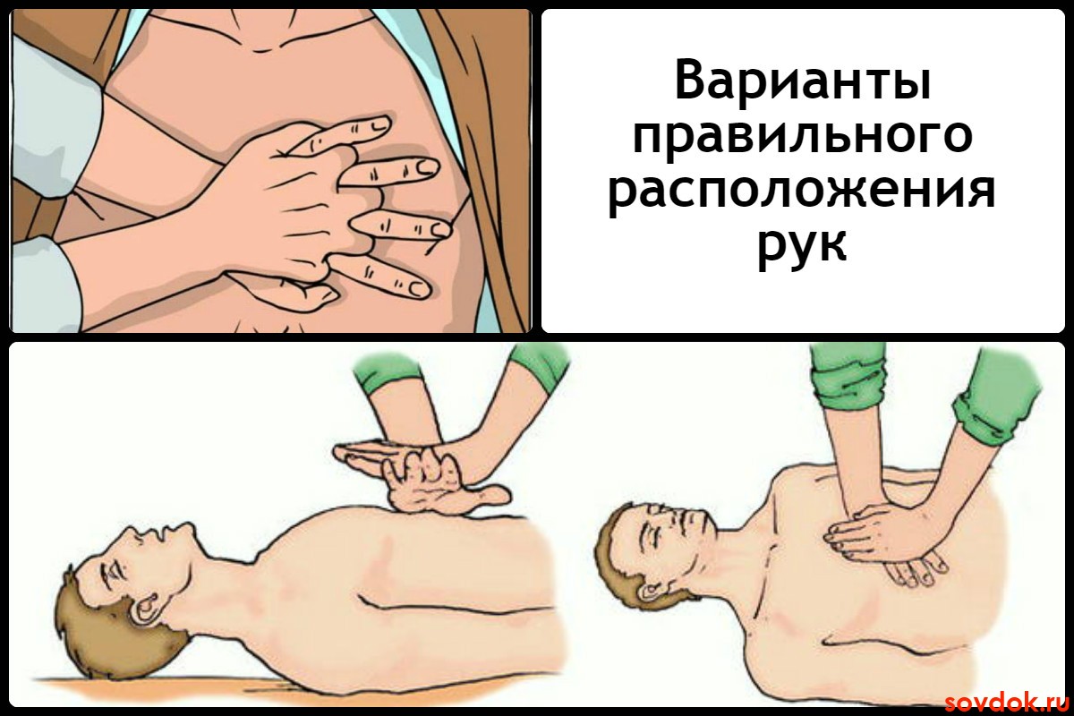 Варианты правильного расположения рук