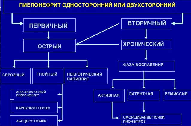 Классификация пиелонефрита